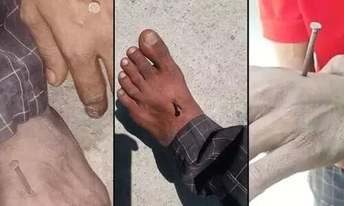 യു.പിയിൽ മാസ്​ക്​ ധരിക്കാത്ത യുവാവിന്‍റെ കൈകാലുകളിൽ പൊലീസ്​ ആണിയടിച്ച്​ കയറ്റിയെന്ന്​ മാതാവിന്‍റെ പരാതി