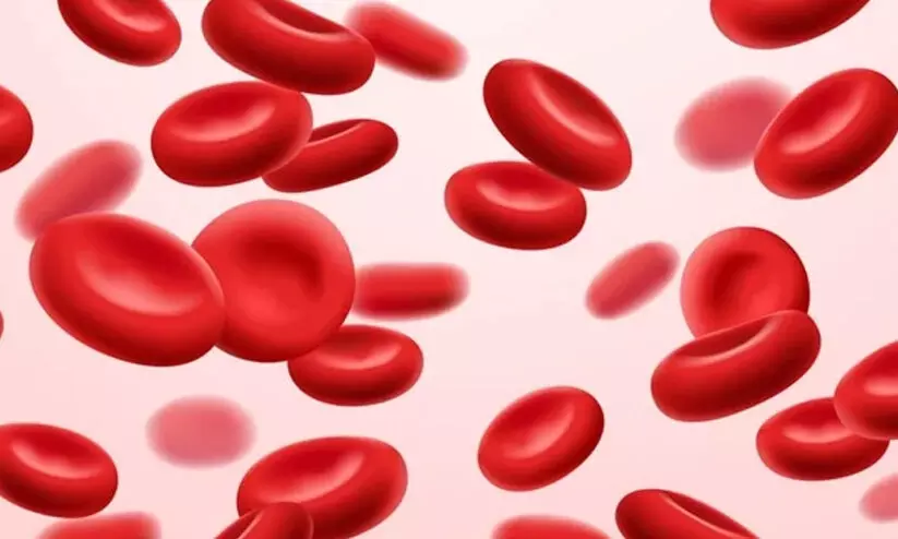 കോളനിവാസികള്‍ക്കിടയില്‍ വിളര്‍ച്ചരോഗം വ്യാപകം; ആശങ്കപ്പെടേണ്ടതില്ലെന്ന്​ അധികൃതർ