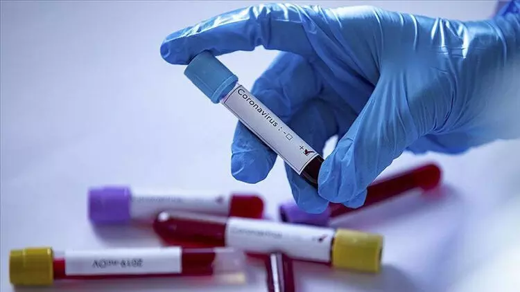 12,300 പേർക്ക്കൂടി കോവിഡ്; 174 മരണം 12,300 പേർക്ക്കൂടി കോവിഡ്; 174 മരണം