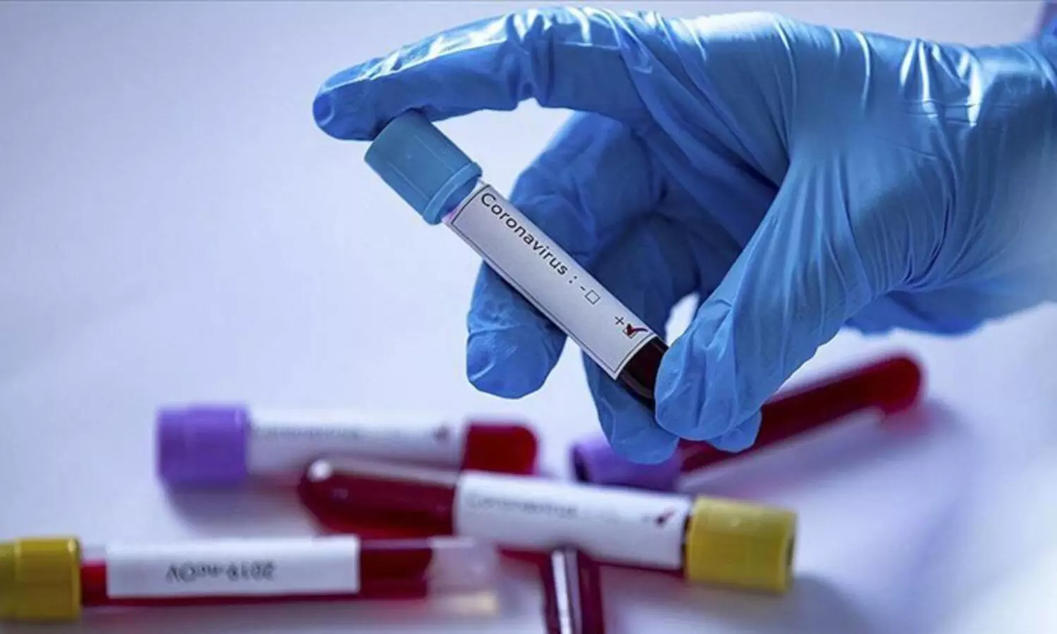 12,300 പേർക്ക്കൂടി കോവിഡ്; 174 മരണം