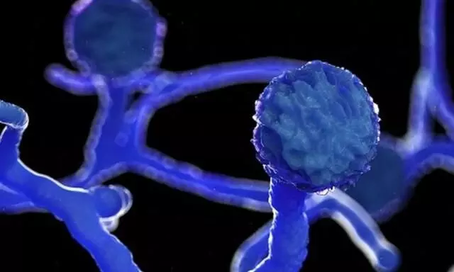 കൊച്ചിയിൽ കോവിഡ് ചികിത്സയിൽ കഴിയുന്ന യുവതിക്ക് ബ്ലാക് ഫംഗസ് ബാധ