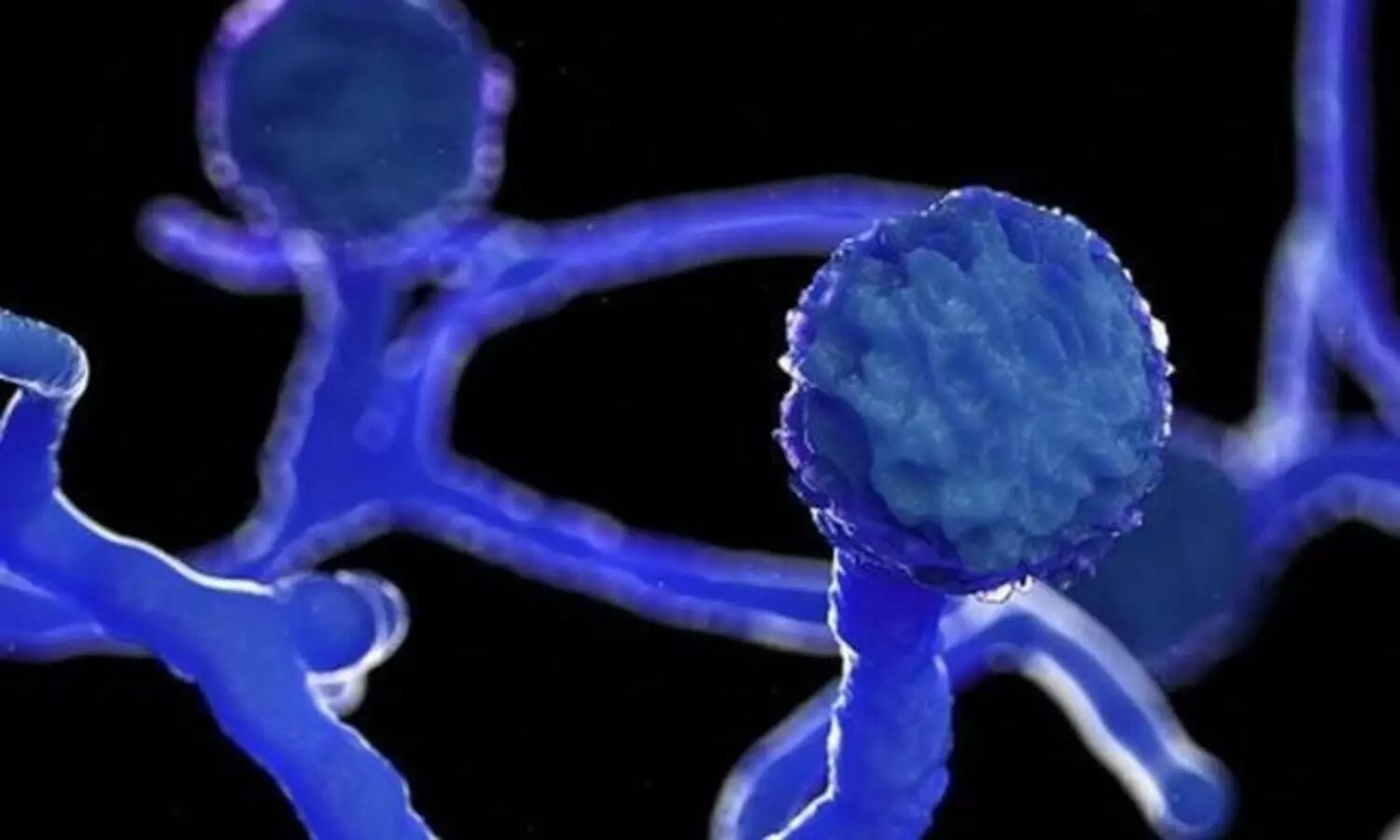 ബ്ലാക്ക് ഫംഗസ്: കാഞ്ഞിരപ്പുഴ സ്വദേശിനി മരിച്ചു