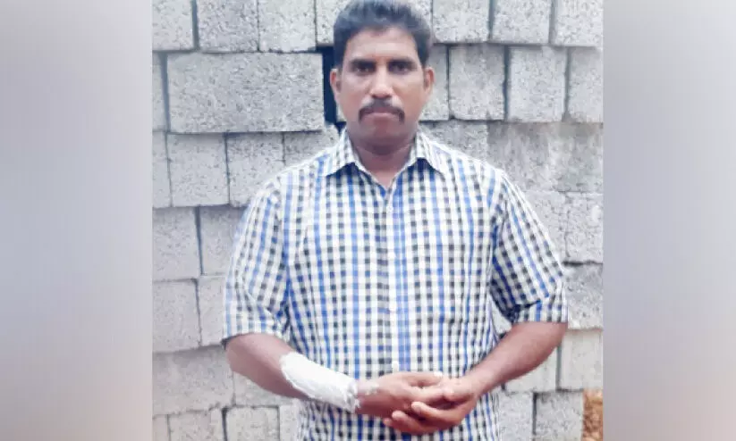 ഡ്രൈവറുടെ ദേഹത്ത് പെട്രോളൊഴിച്ച് പൊള്ളലേൽപിച്ചതായി പരാതി