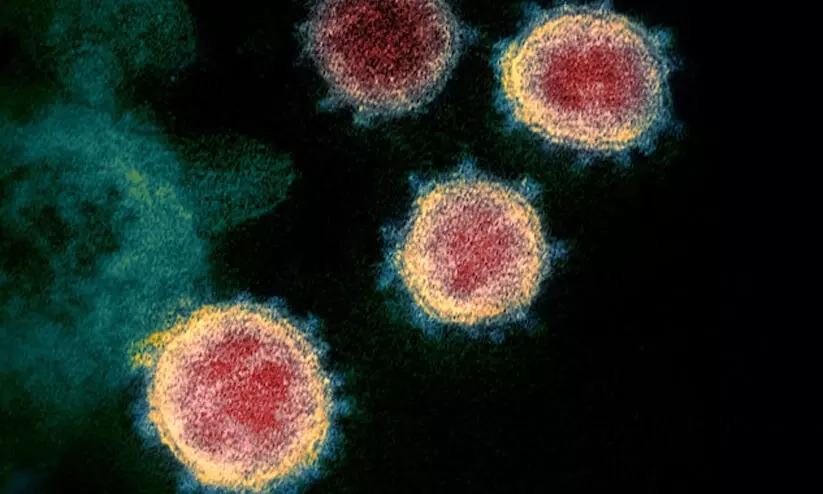 കോവിഡ്; സൗദിയിൽ ഇന്ന് 1,109 പുതിയ രോഗികളും 1,148 രോഗമുക്തിയും കോവിഡ്; സൗദിയിൽ ഇന്ന് 1,109 പുതിയ രോഗികളും 1,148 രോഗമുക്തിയും