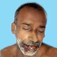 അ​വ​ശ​നി​ല​യി​ൽ ക​ണ്ടെ​ത്തി​യ​യാ​ൾ ആ​ശു​പ​ത്രി​യി​ൽ മ​രി​ച്ചു