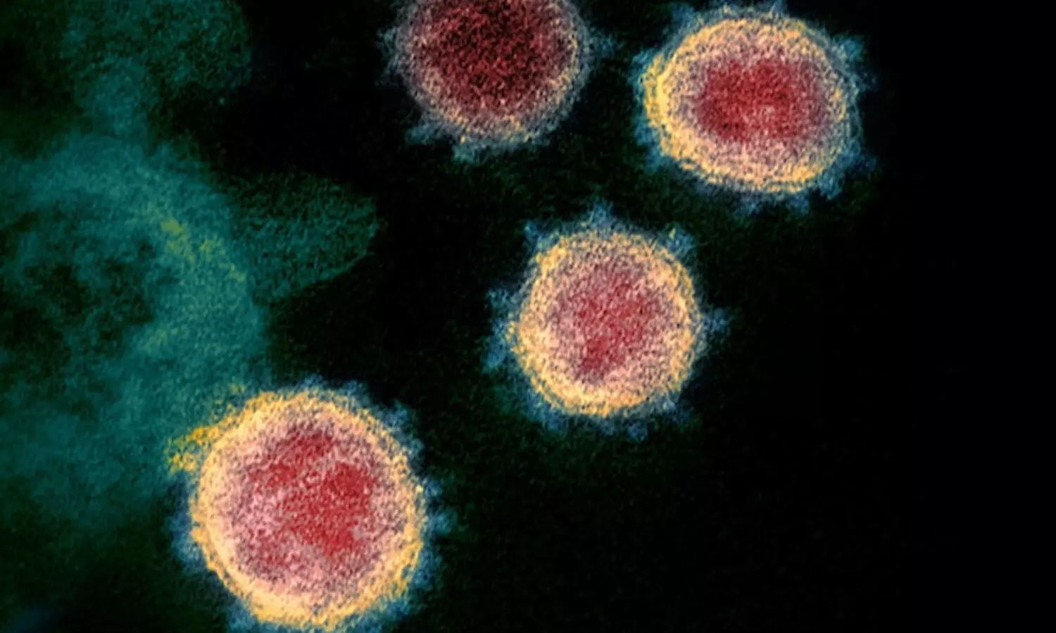 കോവിഡ്; സൗദിയിൽ ഇന്ന് 1,109 പുതിയ രോഗികളും 1,148 രോഗമുക്തിയും