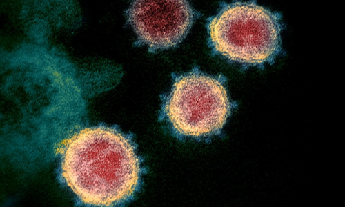 കോവിഡ്; സൗദിയിൽ ഇന്ന് 1,109 പുതിയ രോഗികളും 1,148 രോഗമുക്തിയും