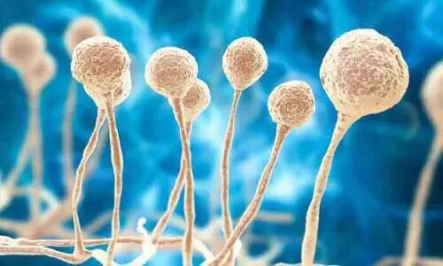 കോവിഡ്: 33 പേർകൂടി മരിച്ചു; ബ്ലാക്ക് ഫംഗസ് സ്ഥിരീകരിച്ചു കോവിഡ്: 33 പേർകൂടി മരിച്ചു; ബ്ലാക്ക് ഫംഗസ് സ്ഥിരീകരിച്ചു