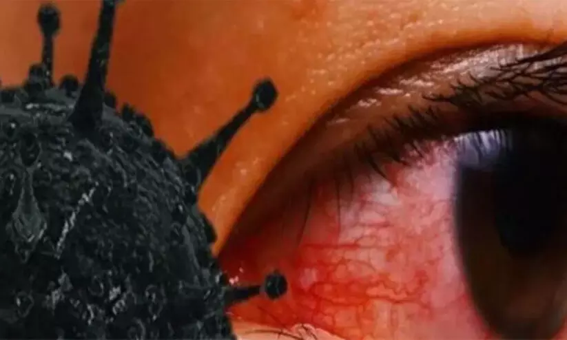 മുംബൈയില്‍ മൂന്നുകുട്ടികളുടെ കണ്ണ് നീക്കം ചെയ്തു; കുട്ടികളിലെ ബ്ലാക്ക് ഫംഗസ് ബാധ ആശങ്കയുയർത്തുന്നു