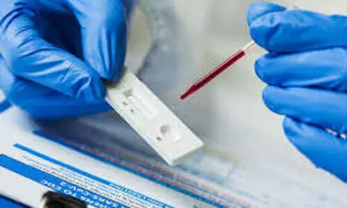 ആൻറിജൻ പരിശോധനയിൽ പോസിറ്റിവായവർ ആർ.ടി.പി.സി.ആറിൽ നെഗറ്റിവ്​