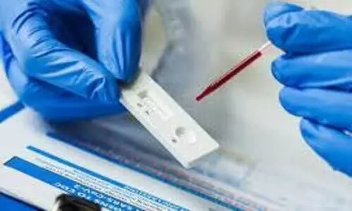 തുടർച്ചയായ അവധികൾ; പരിശോധനയും   വാക്​സിനേഷനും കുറഞ്ഞു