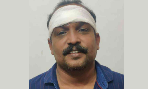 police were attacked-accuse