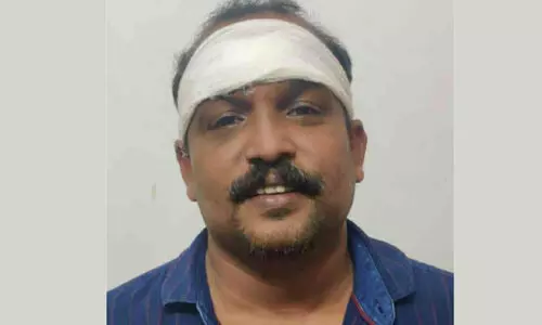 police were attacked-accuse