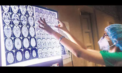 ഇന്ത്യയിൽ ആദ്യമായി ഒരാൾക്ക്​ ബ്ലാക്ക് ഫംഗസ്-ഗ്രീൻ ഫംഗസ് ബാധ