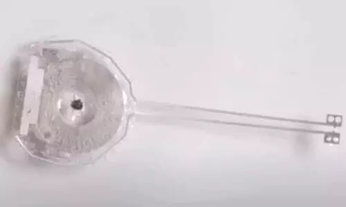 ഹൃദയശ്വാസം ശരിയാക്കാൻ ശരീരത്തിൽ അലിഞ്ഞുചേരും വയർലസ്​ പേസ്മേക്കറുകൾ വരുന്നു