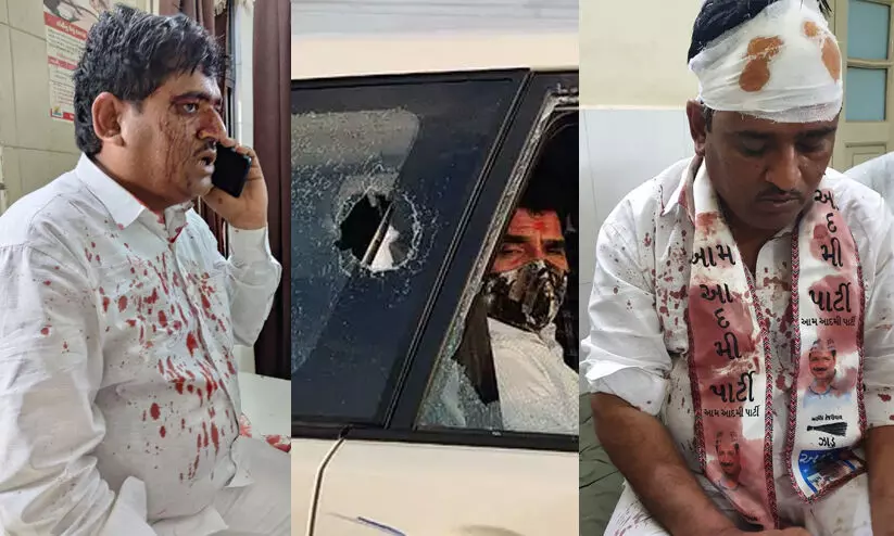 ആം ആദ്മി നേതാക്കള്ക്ക് ഗുജറാത്തില് ബി.ജെ.പിക്കാരുടെ മര്ദനം -വിഡിയോ ആം ആദ്മി നേതാക്കള്ക്ക് ഗുജറാത്തില് ബി.ജെ.പിക്കാരുടെ മര്ദനം -വിഡിയോ