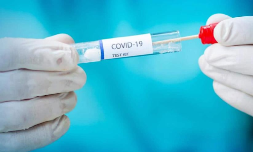 വിമാനത്താവളങ്ങളിലെ കോവിഡ്​ പരിശോധന നിരക്ക്​ നിജപ്പെടുത്തുന്നു