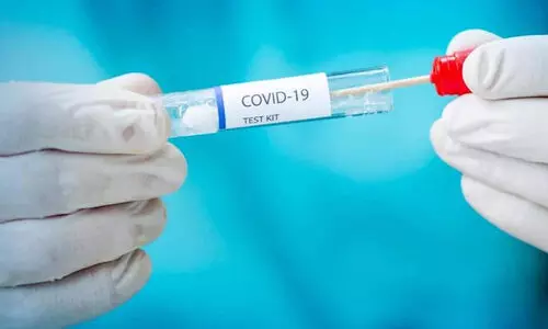 വിമാനത്താവളങ്ങളിലെ കോവിഡ്​ പരിശോധന നിരക്ക്​ നിജപ്പെടുത്തുന്നു