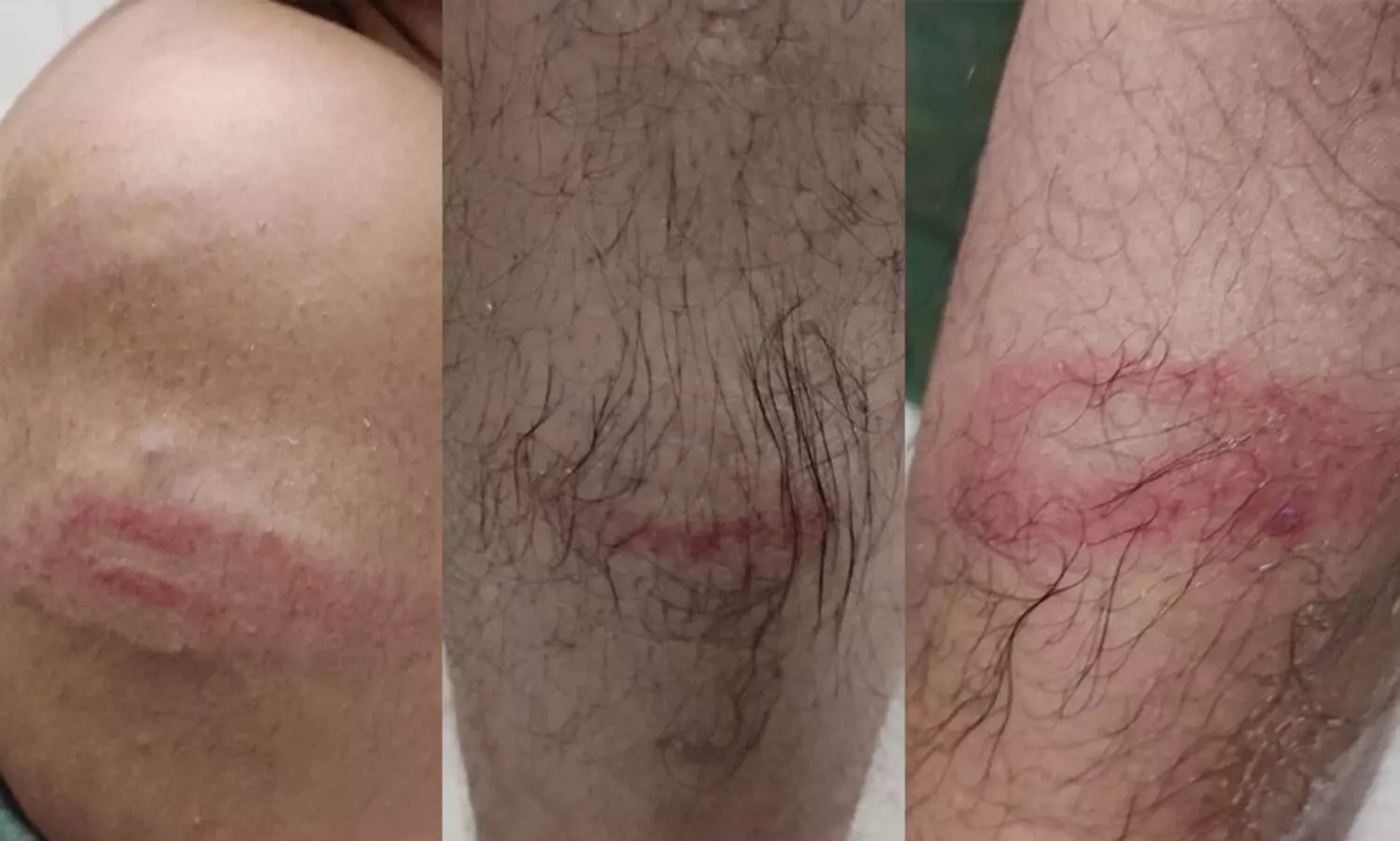 മാധ്യമം ലേഖകന് പൊലീസ് മർദനം