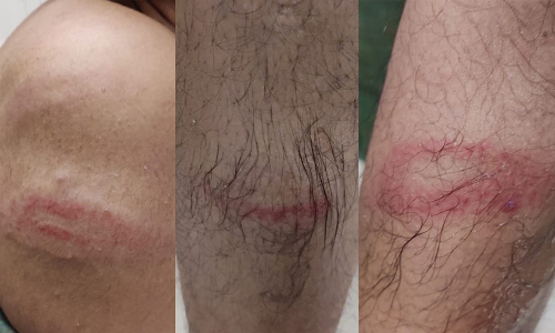 മാധ്യമം ലേഖകന് പൊലീസ് മർദനം