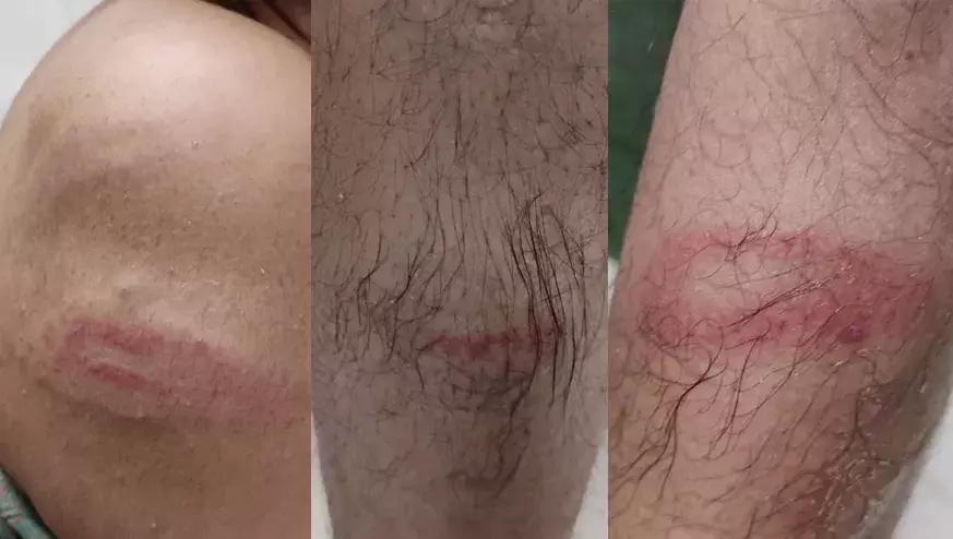 മാധ്യമം ലേഖകന് പൊലീസ് മർദനം