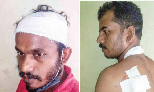 വീ​ടു​ക​യ​റി ആ​ക്ര​മ​ണം: ര​ണ്ടു​പേ​ർ​ക്ക് കു​ത്തേ​റ്റു; പ്ര​തി​ക​ൾ അ​റ​സ്​​റ്റി​ൽ