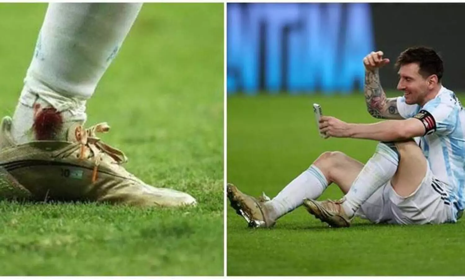 മെസ്സി ഫൈനലിൽ കളിച്ചത്​ പരിക്കുമായി; എ​ത്ര വേദനയോടെയെന്നറിഞ്ഞാൽ നിങ്ങൾ അദ്ദേഹത്തെ കൂടുതൽ ഇഷ്​ടപ്പെടും-കോച്ച്​