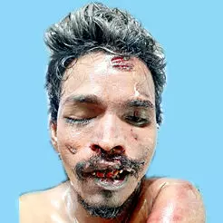 12 ദി​വ​സം മു​മ്പ്​ മ​രി​ച്ച യു​വാ​വി​െൻറ മൃ​ത​ദേ​ഹം സം​സ്ക​രി​ച്ചു