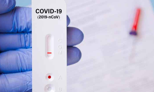 കോ​ഴി വാ​ങ്ങാ​ൻ പോ​യയാൾക്കും പൊലീസ് വക ആ​ൻ​റി​ജ​ൻ ടെ​സ്​​റ്റ്​