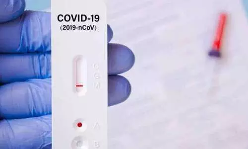 കോഴി വാങ്ങാൻ പോയയാൾക്കും പൊലീസ് വക ആൻറിജൻ ടെസ്റ്റ് കോഴി വാങ്ങാൻ പോയയാൾക്കും പൊലീസ് വക ആൻറിജൻ ടെസ്റ്റ്