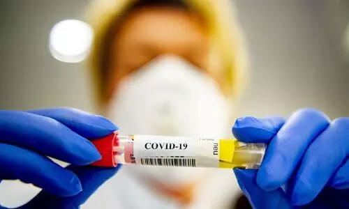 കോവിഡ്; സൗദിയിൽ ഇന്ന് 1293 പുതിയ രോഗികളും 1453 രോഗമുക്തിയും