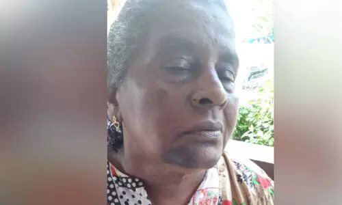 പന്തുകളി വിലക്കിയതിന് വയോധികയെ മര്‍ദിച്ചതായി പരാതി