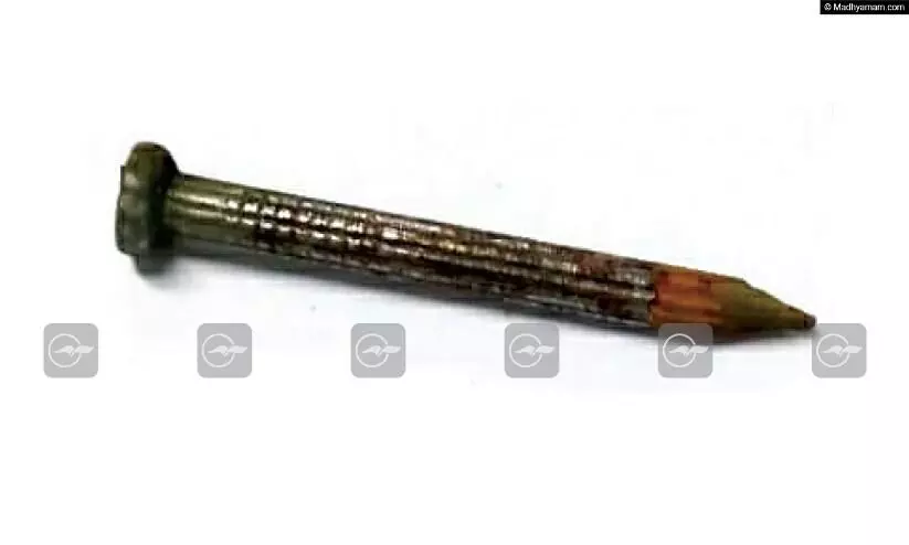 ഒ​ന്ന​ര വ​യ​സ്സു​കാ​ര​ൻ ഇരുമ്പാണി വി​ഴു​ങ്ങി; അതിസ​ങ്കീ​ര്‍ണ​മാ​യ ശ​സ്ത്ര​ക്രി​യയിലുടെ  ഒടുവിൽ പുറത്തെടുത്ത്​