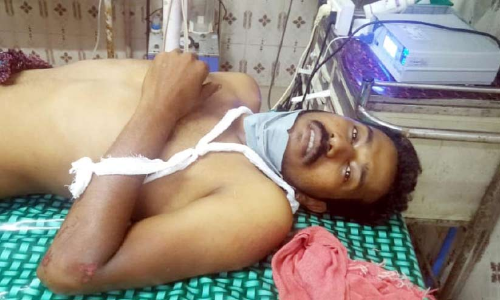 ചിറ്റാർ നീലിപിലാവിൽ യുവാവിനെ കാട്ടാന ആക്രമിച്ചു