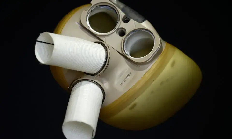 വിലക്കു വാങ്ങാം നിർമിത ഹൃദയവും; ആദ്യ വിൽപന നടത്തി ഫ്രഞ്ച്​ കമ്പനി, വില 1.3 കോടി