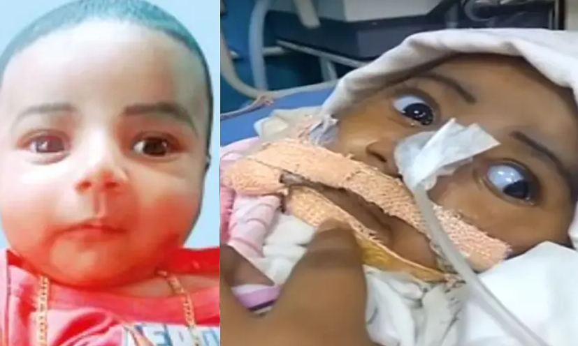 എസ്​.എം.എ രോഗം ബാധിച്ച ഇമ്രാൻ വിടവാങ്ങി; ഇനി വേണ്ട, കോടതിയുടെ കനിവും പതിനെട്ടു കോടിയുടെ മരുന്നും