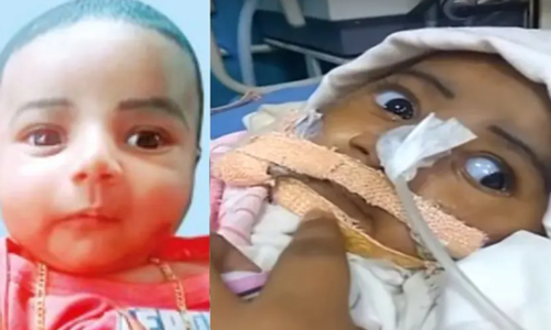 എസ്​.എം.എ രോഗം ബാധിച്ച ഇമ്രാൻ വിടവാങ്ങി; ഇനി വേണ്ട, കോടതിയുടെ കനിവും പതിനെട്ടു കോടിയുടെ മരുന്നും