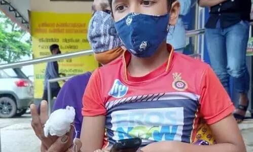 പേപ്പട്ടി ആക്രമണം: ഒമ്പതുകാര​െൻറ വിരൽ നായ്​ കടിച്ചെടുത്തു