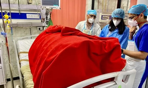 യുവതിയുടെ മുഖത്തേക്ക്​ ആസിഡും തിളച്ച എണ്ണയും ഒഴിച്ച്​ ഭർത്താവ്​; ശക്തമായ നടപടിയാവശ്യപ്പെട്ട്​ ദില്ലി വനിതാ കമീഷൻ