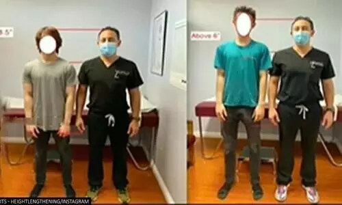 ഉയരം കുറവാണോ? നീളം കൂട്ടാൻ മാന്ത്രിക വിദ്യയുമായി ഡോക്​ടർ; വിഡിയോ വൈറൽ