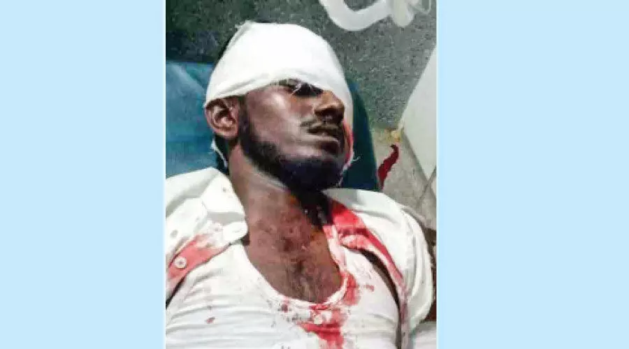 വാൽപ്പാറയിൽ വീണ്ടും കരടി ആക്രമണം; യുവാവിന് പരിക്ക്