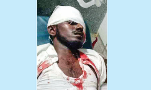 വാൽപ്പാറയിൽ വീണ്ടും കരടി ആക്രമണം; യുവാവിന് പരിക്ക്