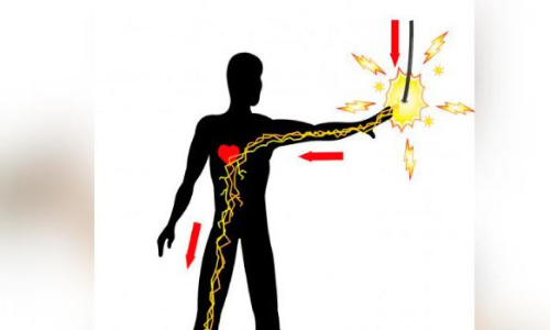 വൈദ്യുതിയോട്​ കരുത​ലേറെ വേണം, മലപ്പുറം ജി​ല്ല​യി​ൽ ഇൗ ​വ​ർ​ഷം വൈ​ദ്യു​തി അ​പ​ക​ട​ങ്ങ​ളി​ൽ ജീ​വ​ൻ പൊ​ലി​ഞ്ഞ​ത്​ ഒ​മ്പ​ത്​​​ പേ​ർ​ക്ക്​