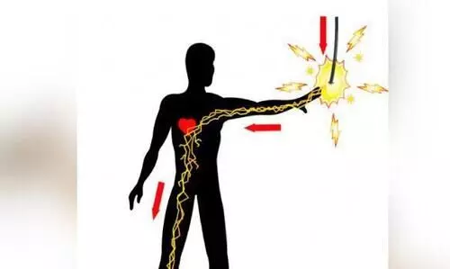 വൈദ്യുതിയോട്​ കരുത​ലേറെ വേണം, മലപ്പുറം ജി​ല്ല​യി​ൽ ഇൗ ​വ​ർ​ഷം വൈ​ദ്യു​തി അ​പ​ക​ട​ങ്ങ​ളി​ൽ ജീ​വ​ൻ പൊ​ലി​ഞ്ഞ​ത്​ ഒ​മ്പ​ത്​​​ പേ​ർ​ക്ക്​