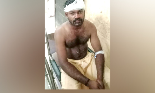 ആക്രിക്കട ഉടമയെ വെട്ടിപ്പരിക്കേൽപിച്ചു