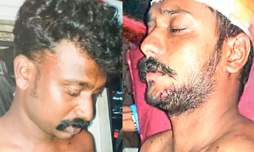 കോൺട്രാക്ടറും തൊഴിലാളികളും തമ്മിൽ തർക്കം; മൂന്നുപേർക്ക് കുത്തേറ്റു കോൺട്രാക്ടറും തൊഴിലാളികളും തമ്മിൽ തർക്കം; മൂന്നുപേർക്ക് കുത്തേറ്റു