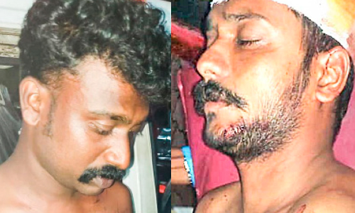 കോൺട്രാക്ടറും തൊഴിലാളികളും  തമ്മിൽ തർക്കം; മൂന്നുപേർക്ക് കുത്തേറ്റു