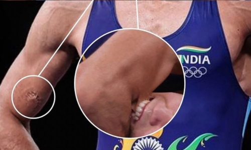 സെമിക്കിടെ രവികുമാറിന്‍റെ കൈ കടിച്ചുപറിച്ച്​ എതിരാളി; ബഹുമാനം കൂടിയെന്ന്​ ആരാധകർ-VIDEO