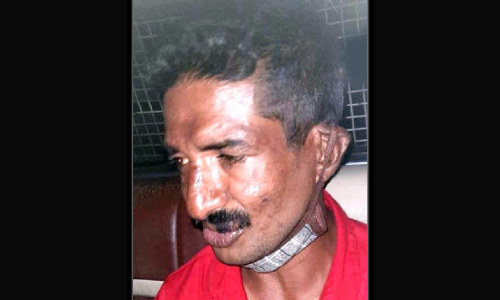 മ​ധ്യ​വ​യ​സ്​​ക​നെ കൊ​ല​പ്പെ​ടു​ത്താ​ൻ ശ്ര​മി​ച്ച യു​വാ​വ് അ​റ​സ്​​റ്റി​ൽ