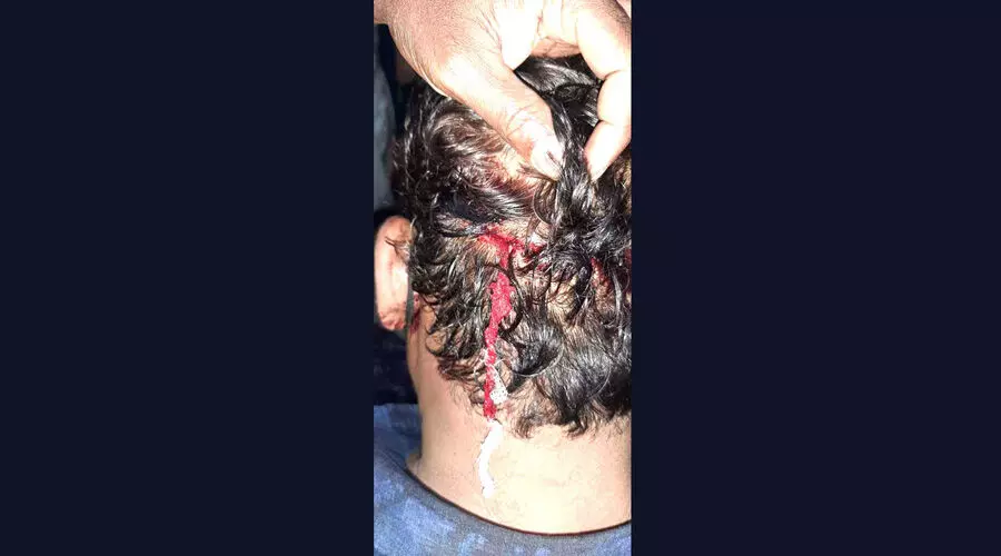 സി.പി.എം വിട്ട് സി.പി.െഎയിൽ ചേർന്നയാൾക്ക് മർദനം സി.പി.എം വിട്ട് സി.പി.െഎയിൽ ചേർന്നയാൾക്ക് മർദനം